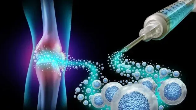 A syringe is being used to inject a cell into a knee.