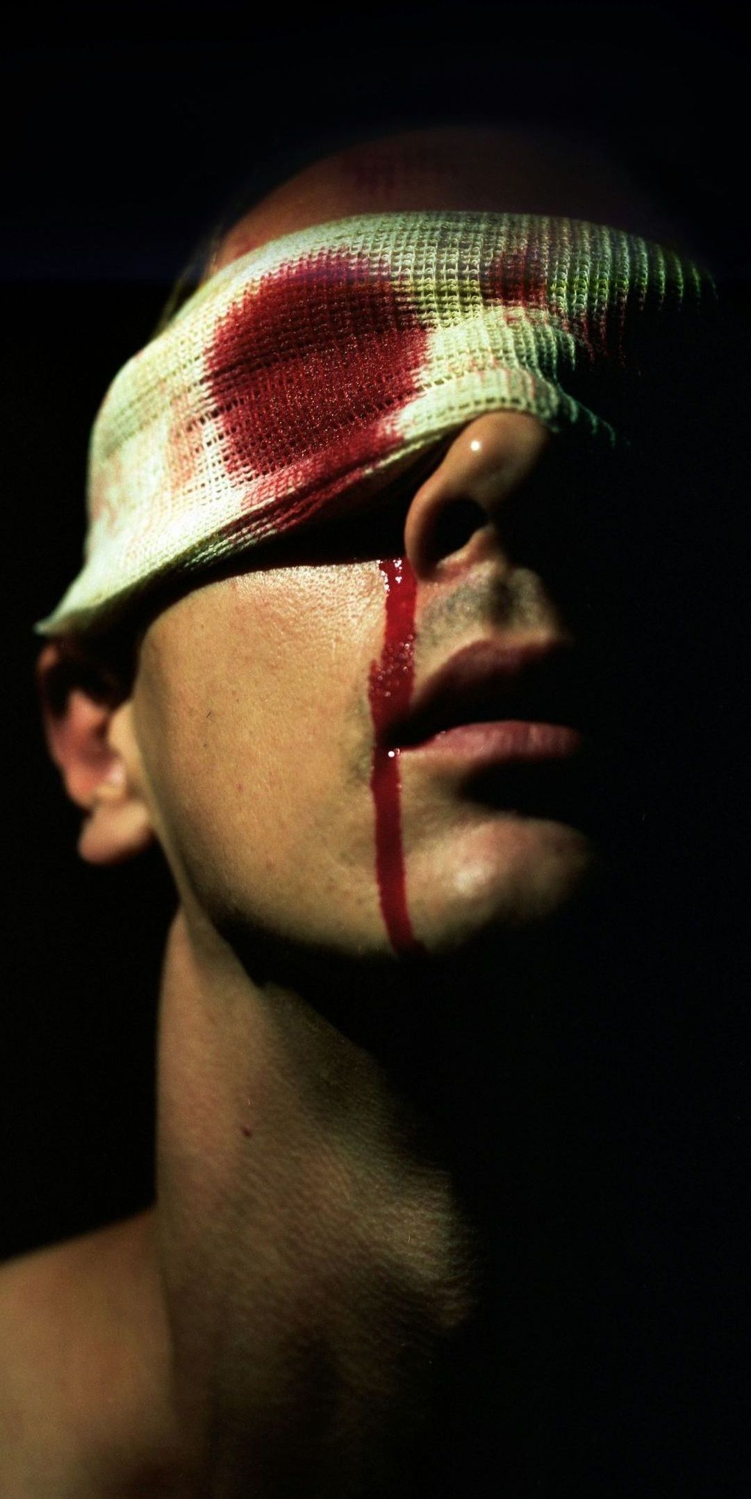 man with a bloody bandage on his head