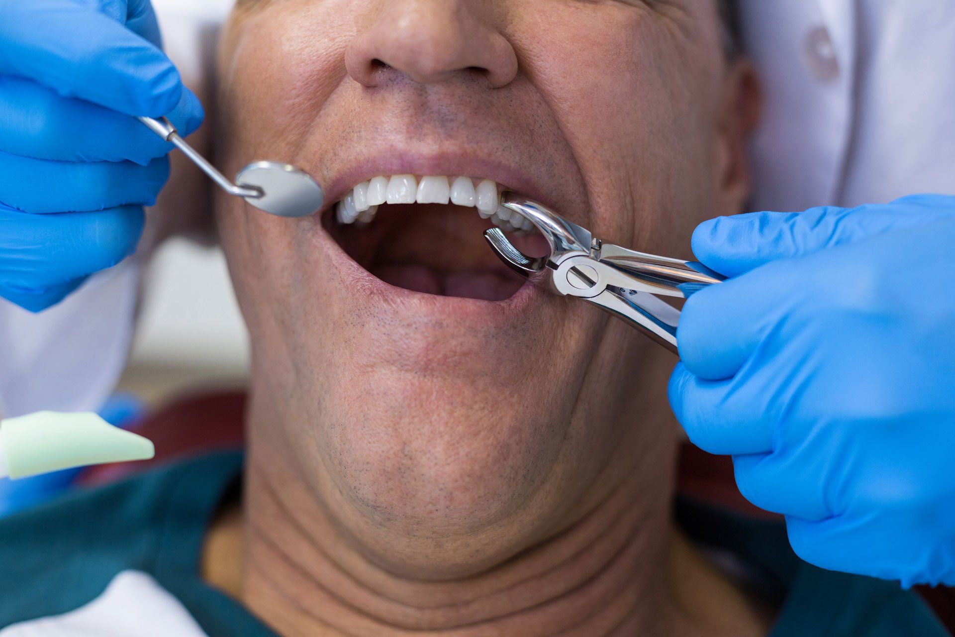 Pulling Teeth — Pittsburgh, PA — Pittsburgh Dental Spa