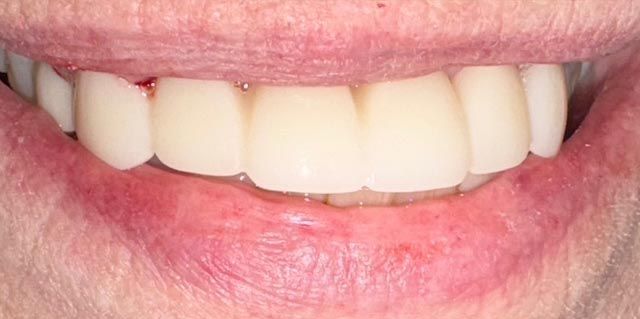 Close-up of a smiling mouth with white teeth and pink lips