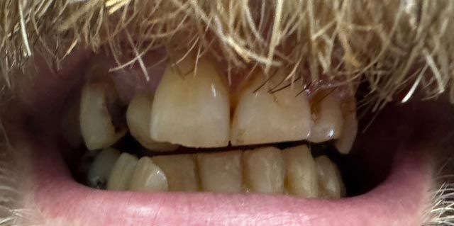 Close-up of a mouth with teeth showing and lips parted, with short light-brown hair above the upper lip