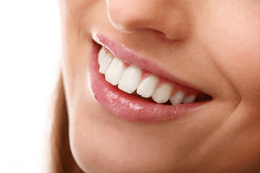 Woman Smiling — Pittsburgh, PA — Pittsburgh Dental Spa