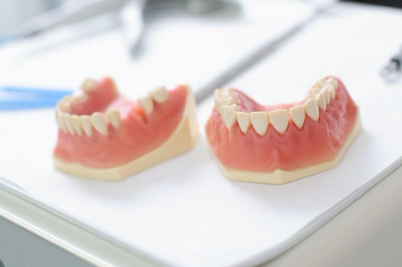 Teeth and Gums Model — Pittsburgh, PA — Pittsburgh Dental Spa