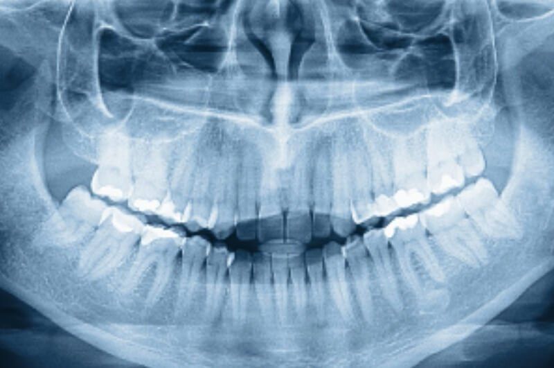 X-Ray — Pittsburgh, PA — Pittsburgh Dental Spa