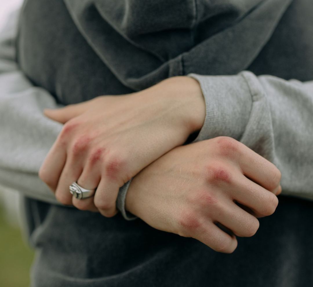 A person with a ring on their finger is hugging another person