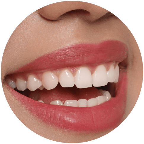 Close-up of a smiling mouth with bright white teeth and red lipstick.