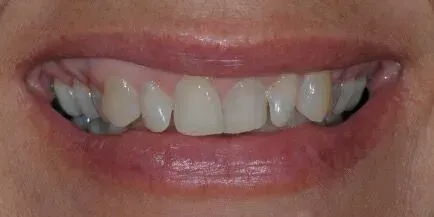 Close-up of a person's mouth with a smile, showing visible teeth and pink lips.