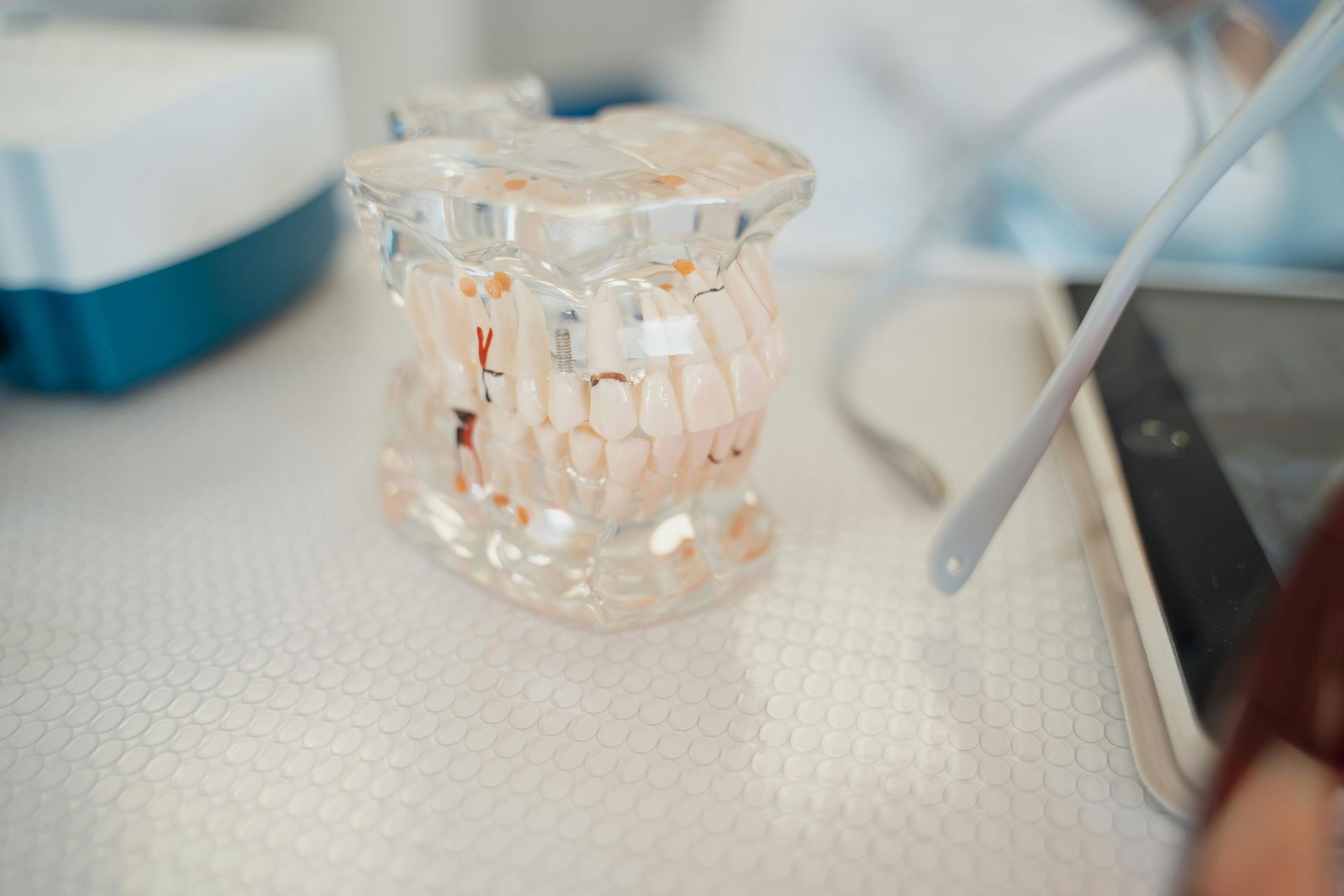 Clear plastic dental model on a white surface, with dental tools and equipment in the blurred background.
