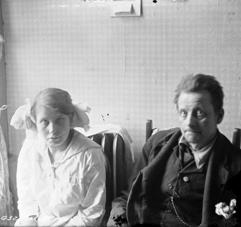 A young man and woman with intellectual disabilities living in slum housing in Toronto. The young woman has blonde hair styled in two ponytails and is wearing a sailor style blouse. The young man has dark messy hair and is wearing a rumpled three piece suit. Images like this were taken by the Toronto Department of Health and used as eugenics propaganda by organizations like the Canadian National Committee for Mental Hygiene (today the Canadian Mental Health Association). This propaganda was designed to convince the public that those deemed disabled were a threat to society which must be eliminated.