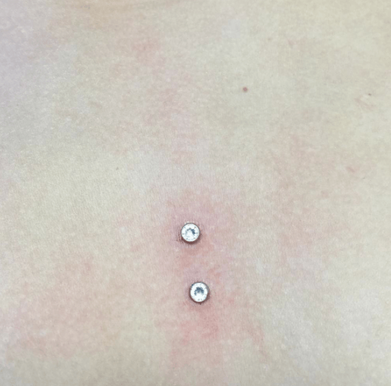 A close up of a person 's back with two piercings.