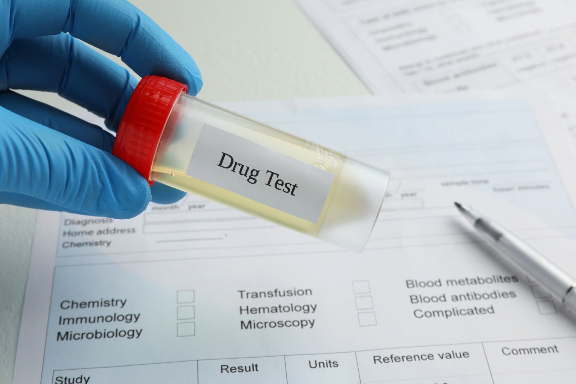 Gloved hand holding a urine sample labeled 