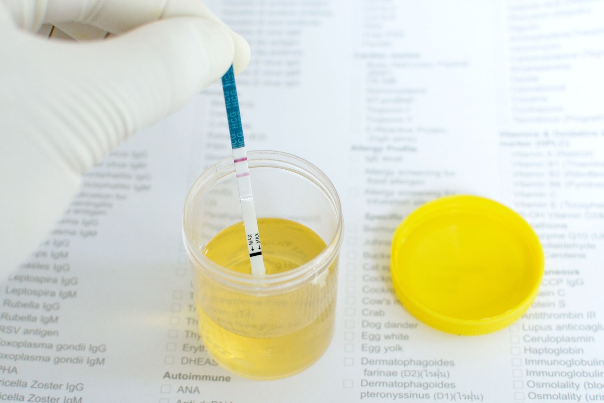 Microscope on a lab bench, surrounded by beakers, test tubes, and petri dishes; scientific lab environment.