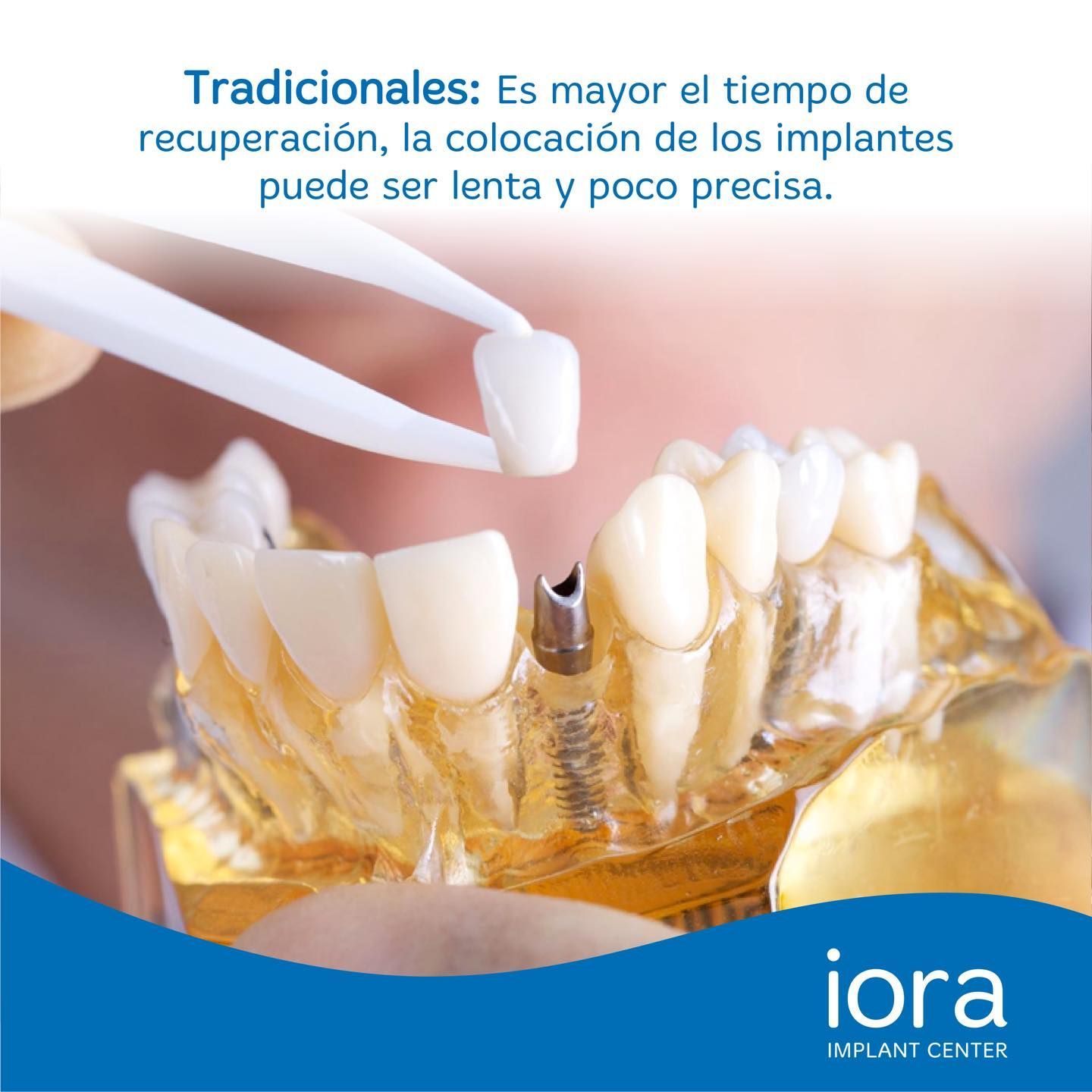 CLÍNICA IORA IMPLANT CENTER