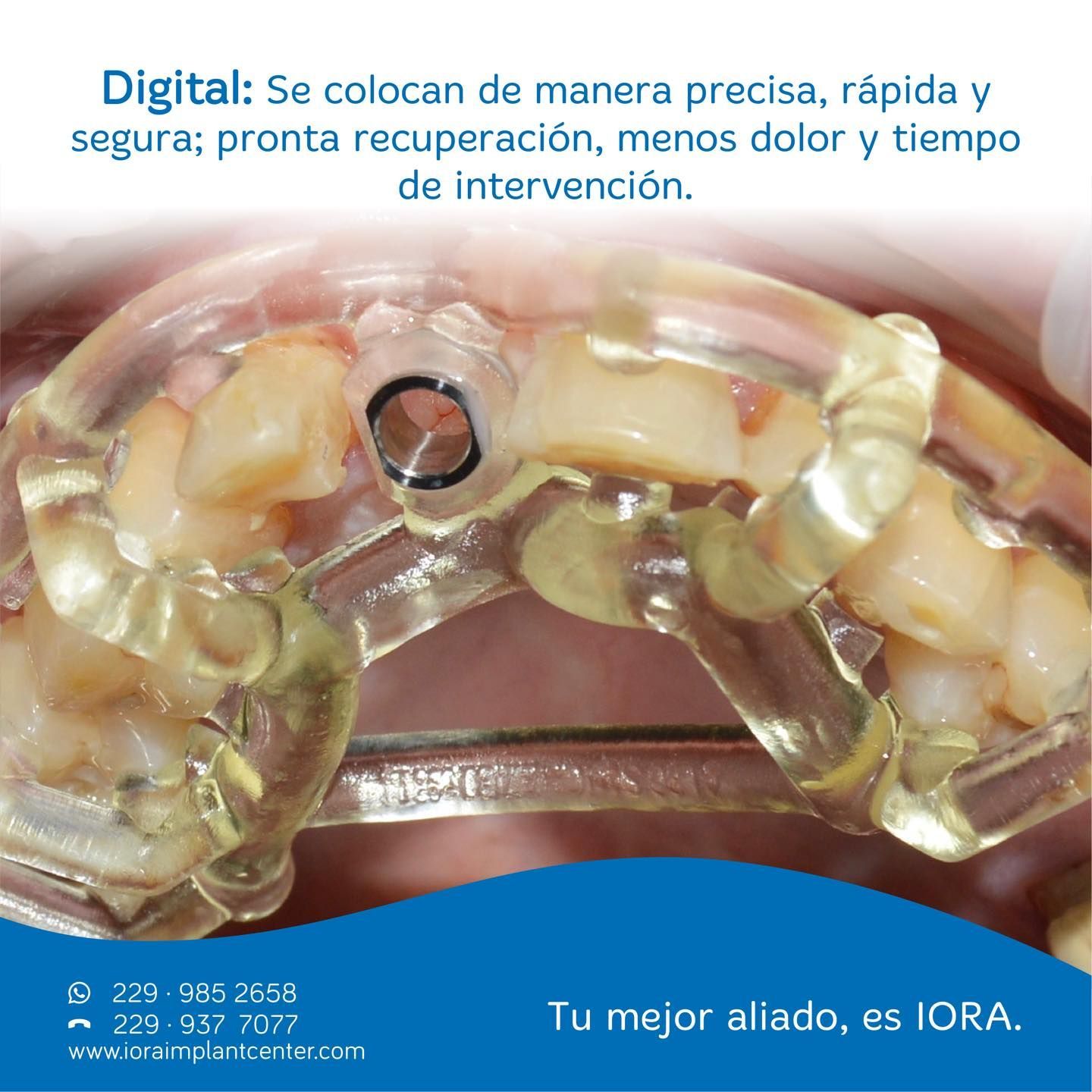 CLÍNICA IORA IMPLANT CENTER