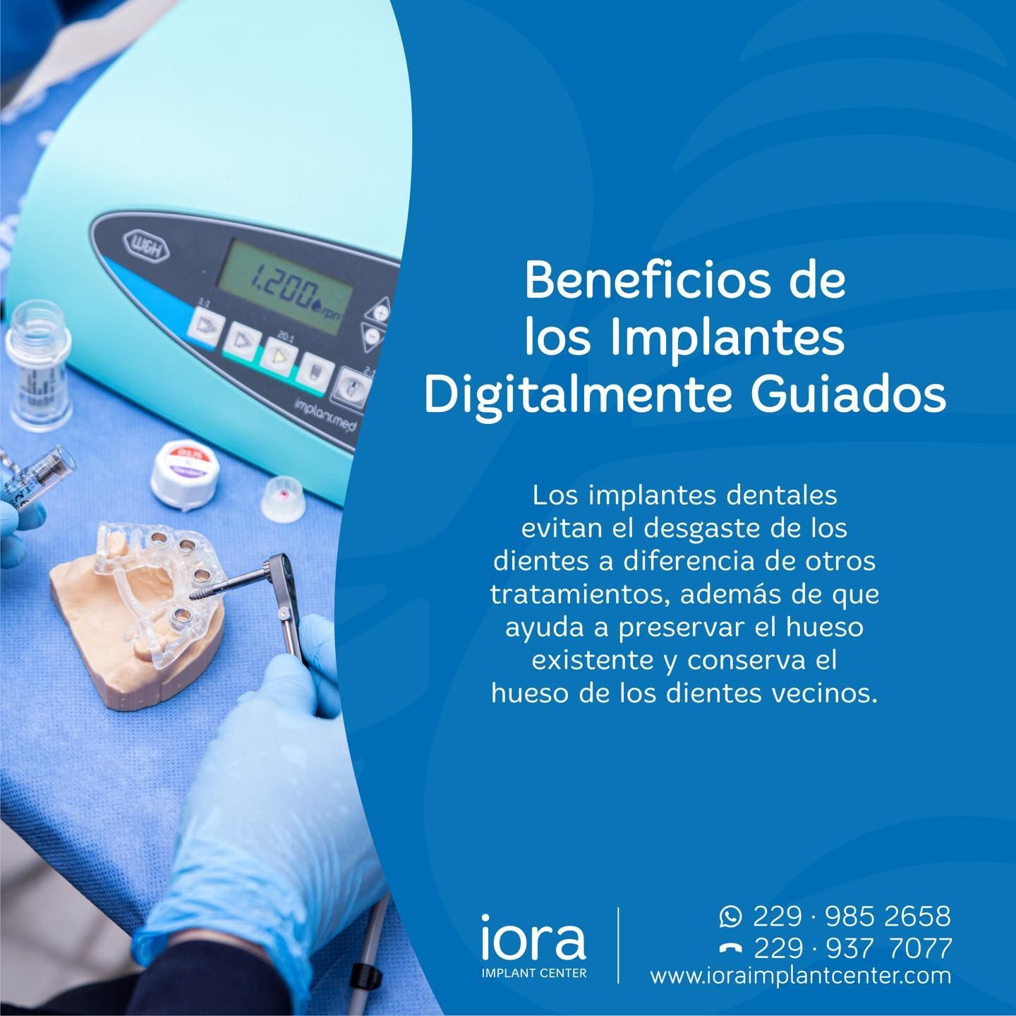 CLÍNICA IORA IMPLANT CENTER