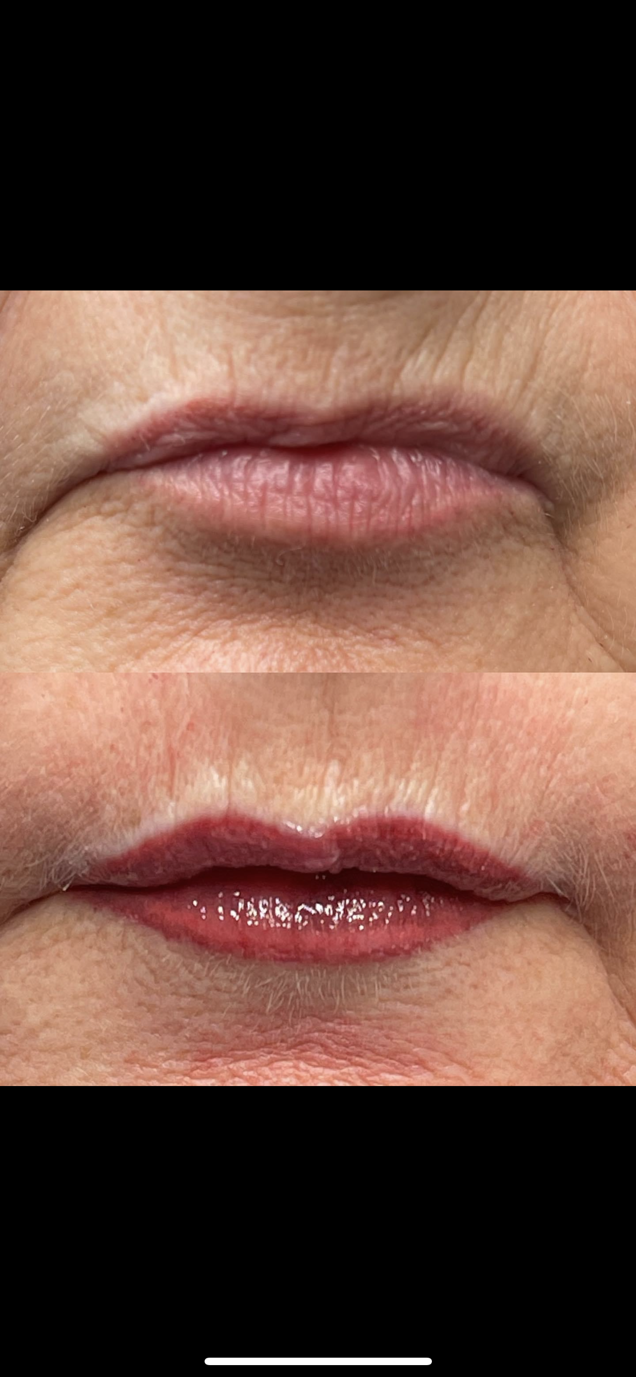 A before and after picture of a woman 's lips.