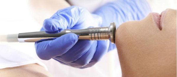 trattamento antiacne