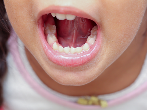 A close up of a little girl's mouth with her mouth open.