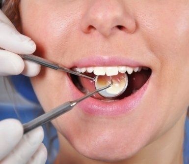 studio dentistico, studio odontoiatrico, pulizia denti