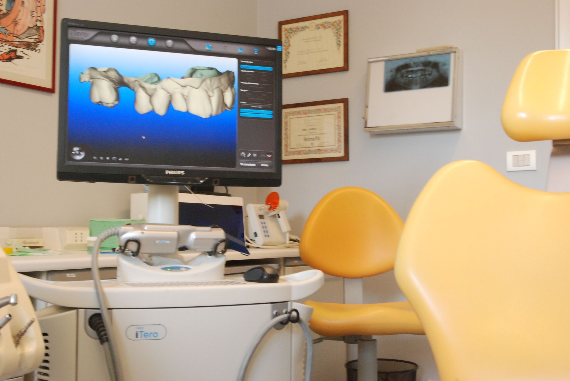 Studio dentistico, poltrona e modello dentale digitale sullo schermo. Poltrona gialla, parete marrone chiaro con certificati incorniciati.