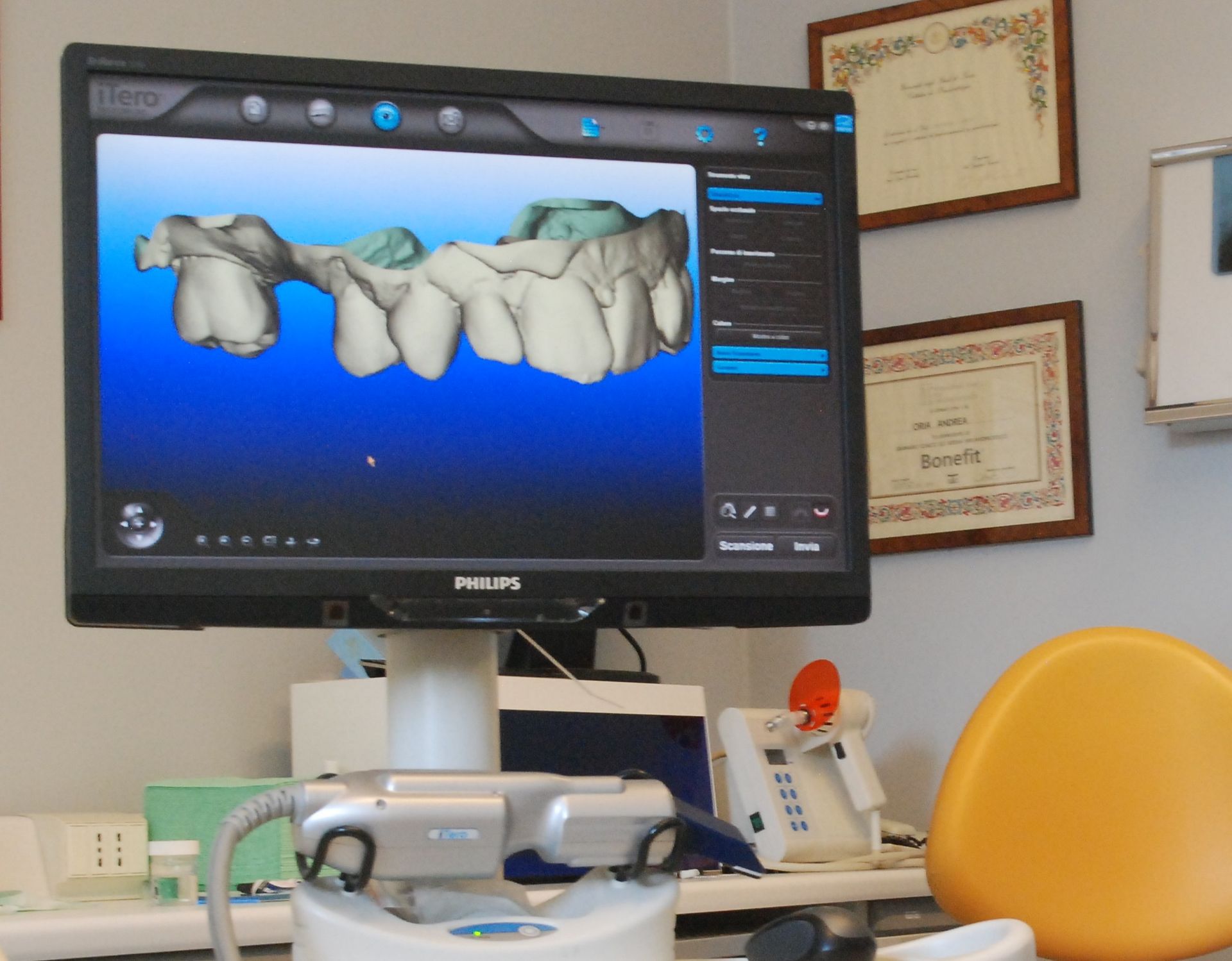 Scansione dentale su un monitor, che mostra il modello 3D dei denti. Sono visibili lo scanner e la poltrona del dentista.