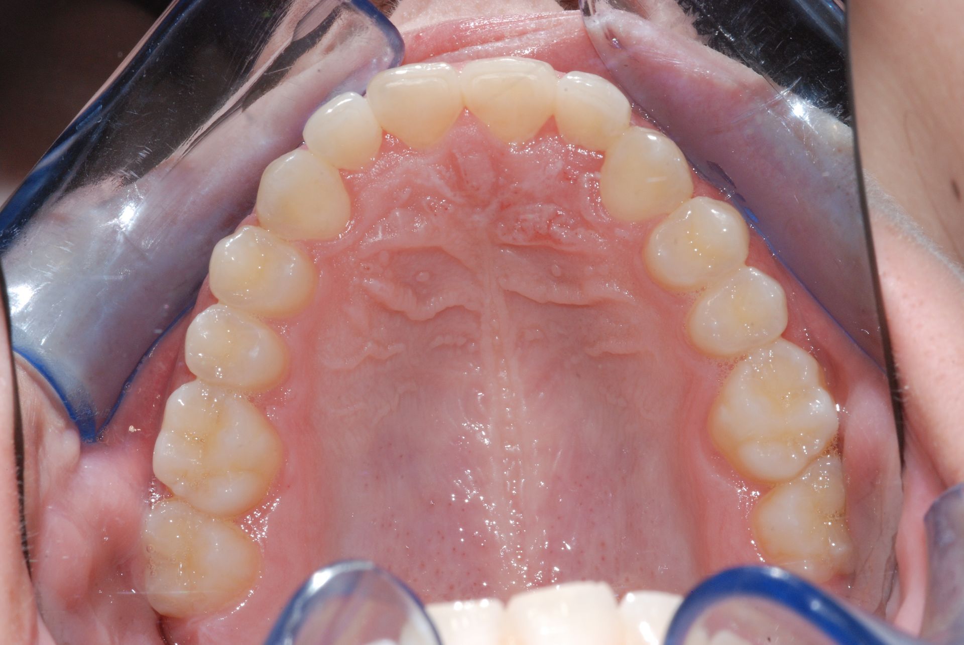 All'interno della bocca sono visibili i denti superiori, di colore giallo chiaro, lungo il palato rosa.