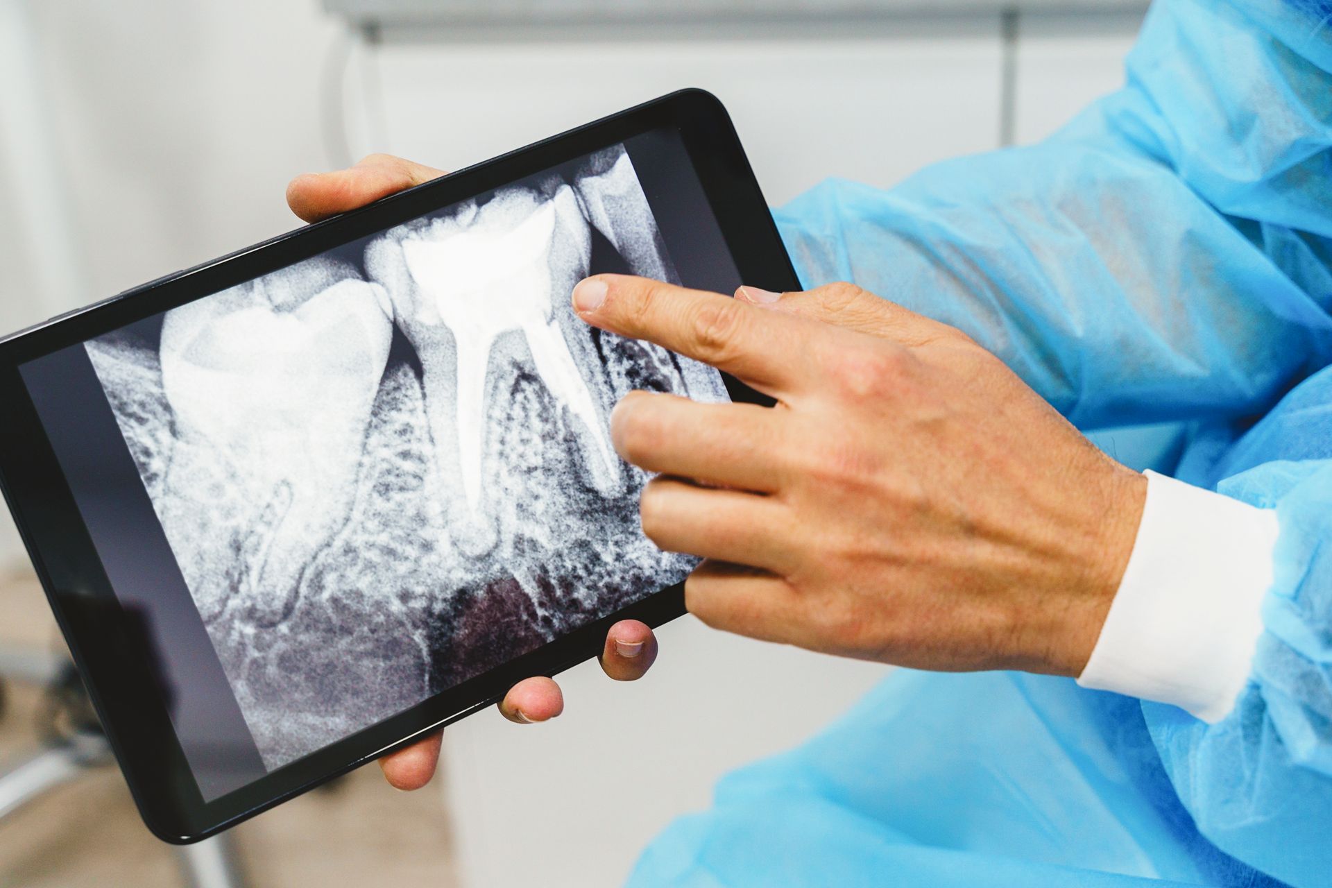 Un dentista in camice blu indica un dente su una radiografia digitale visualizzata su un tablet.