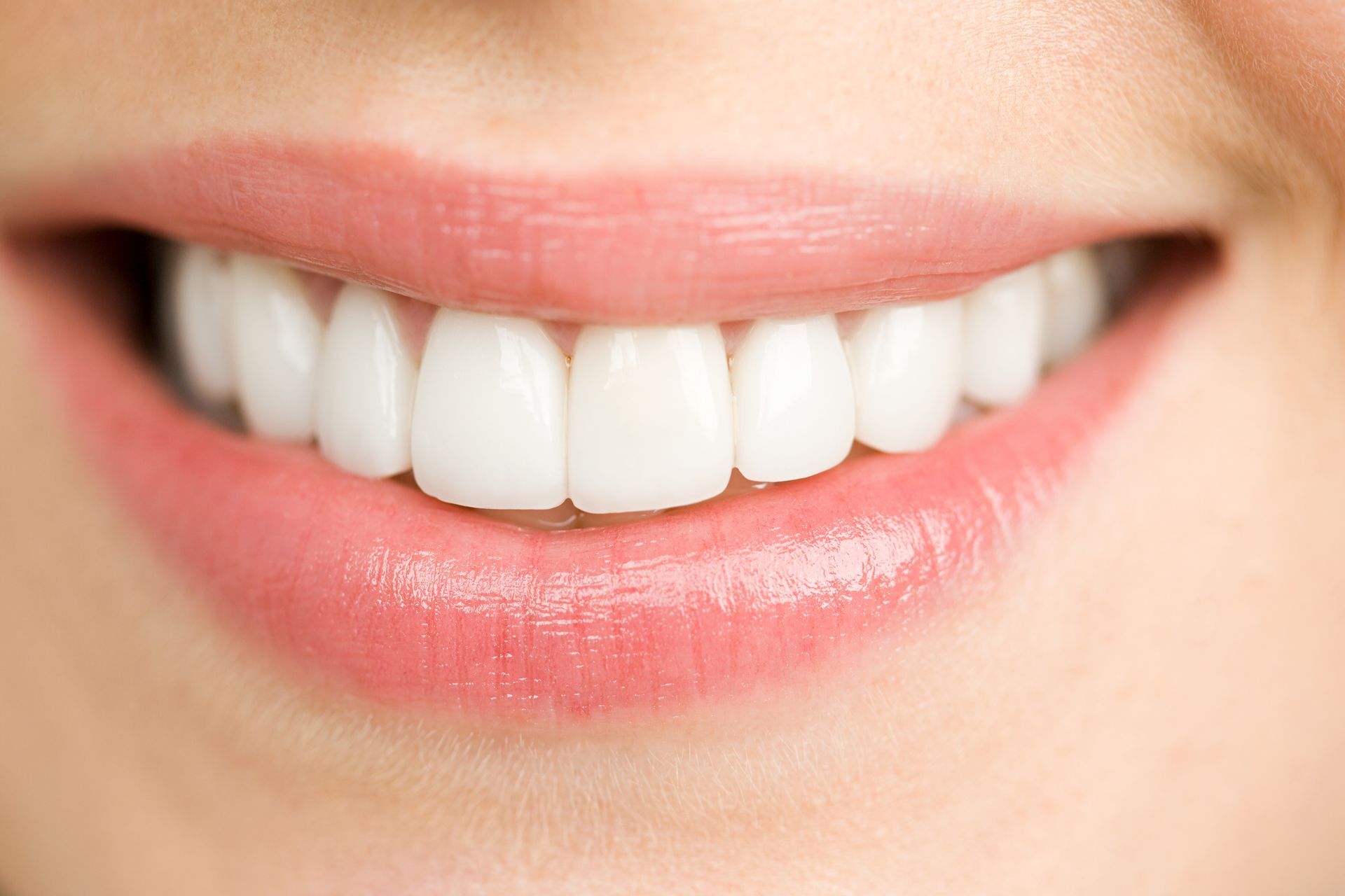 Primo piano di una bocca sorridente, che mostra denti bianchi e brillanti e labbra rosa.