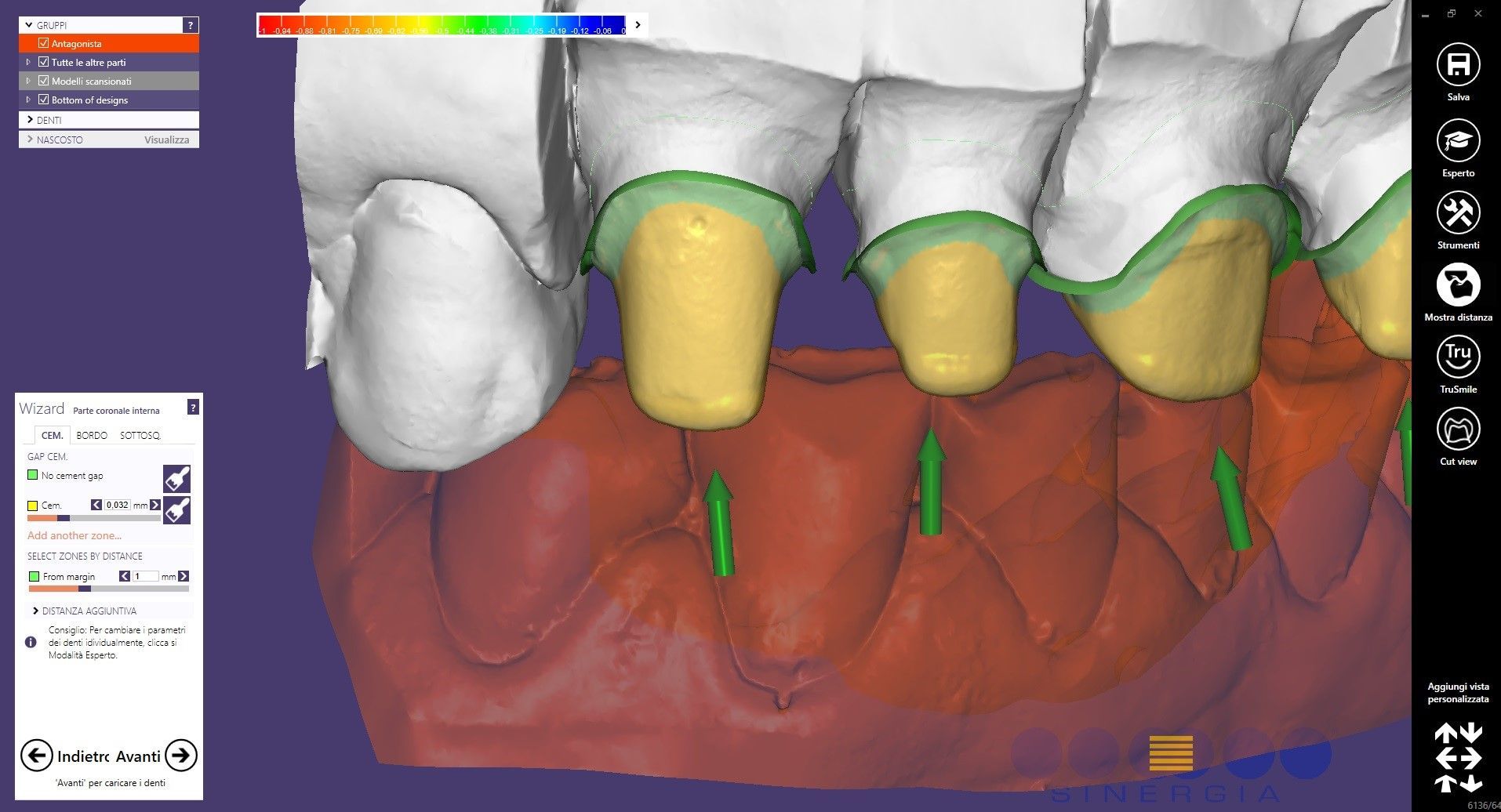 Modello dentale con denti nei colori giallo, verde e bianco, eventualmente per la progettazione o l'analisi dentale.