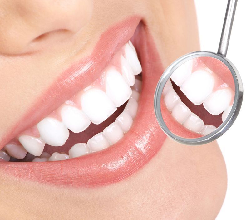 Bocca sorridente con denti bianchi, riflessa in uno specchio dentale.