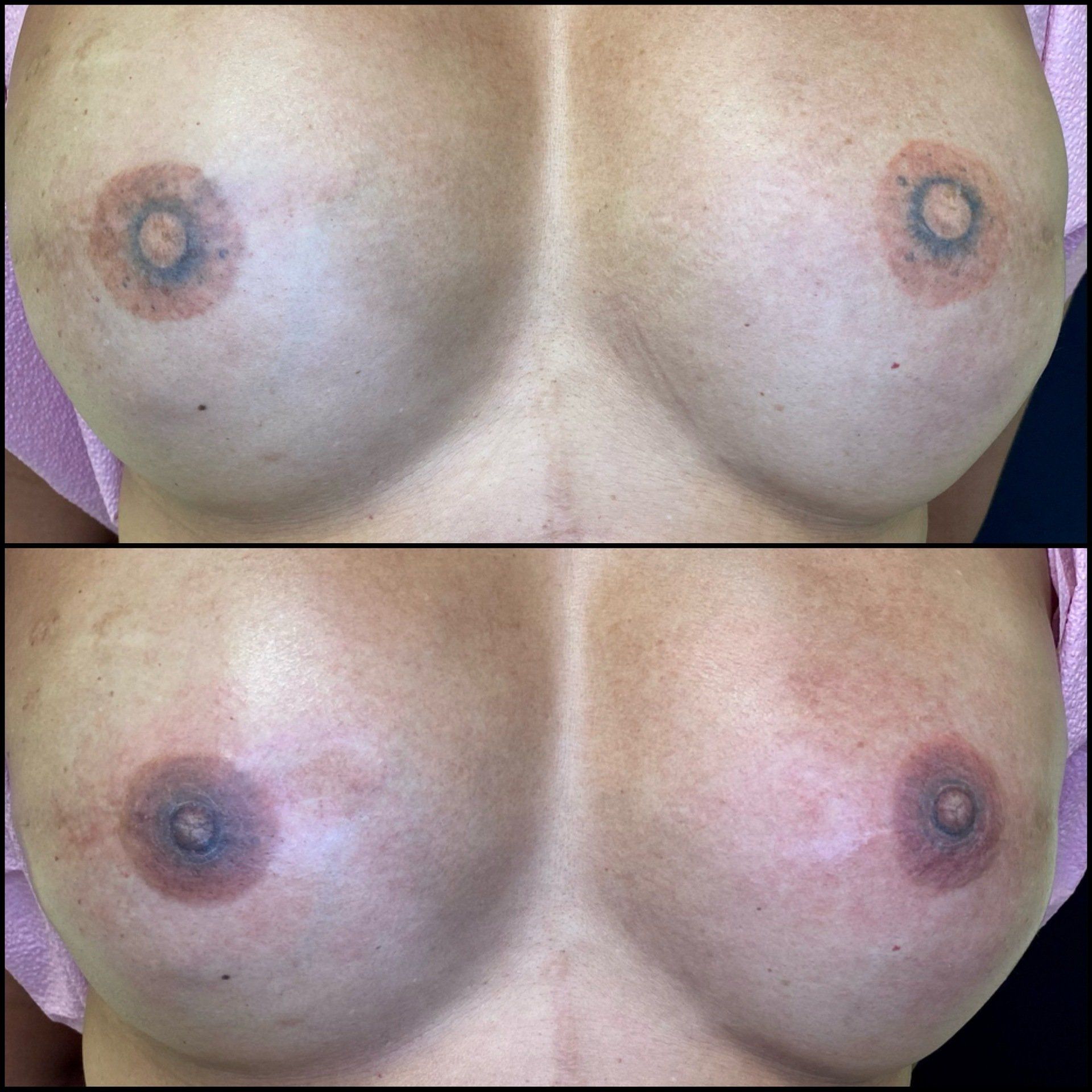 Correction, Before and After