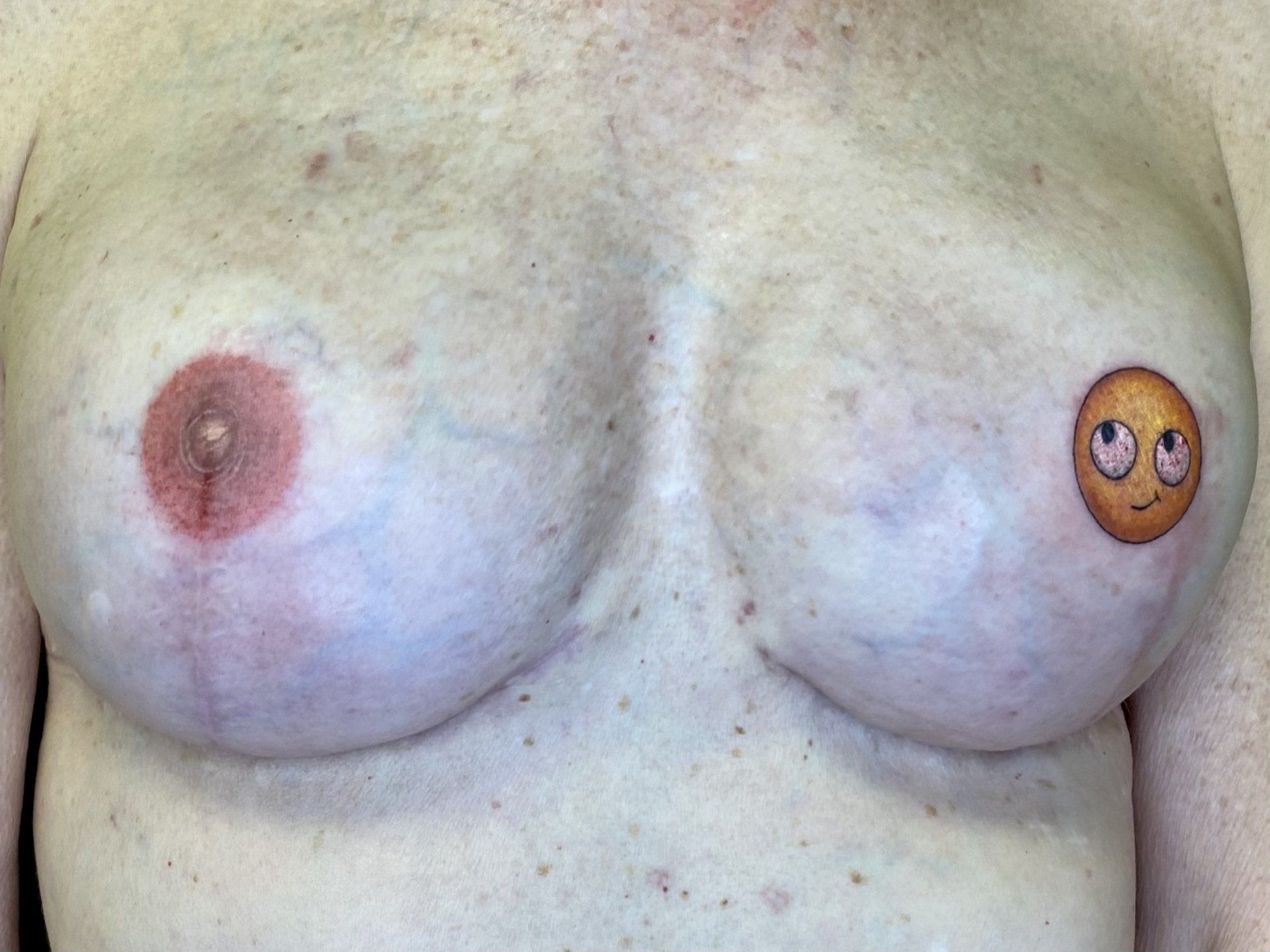 One realistic nipple and one emoji