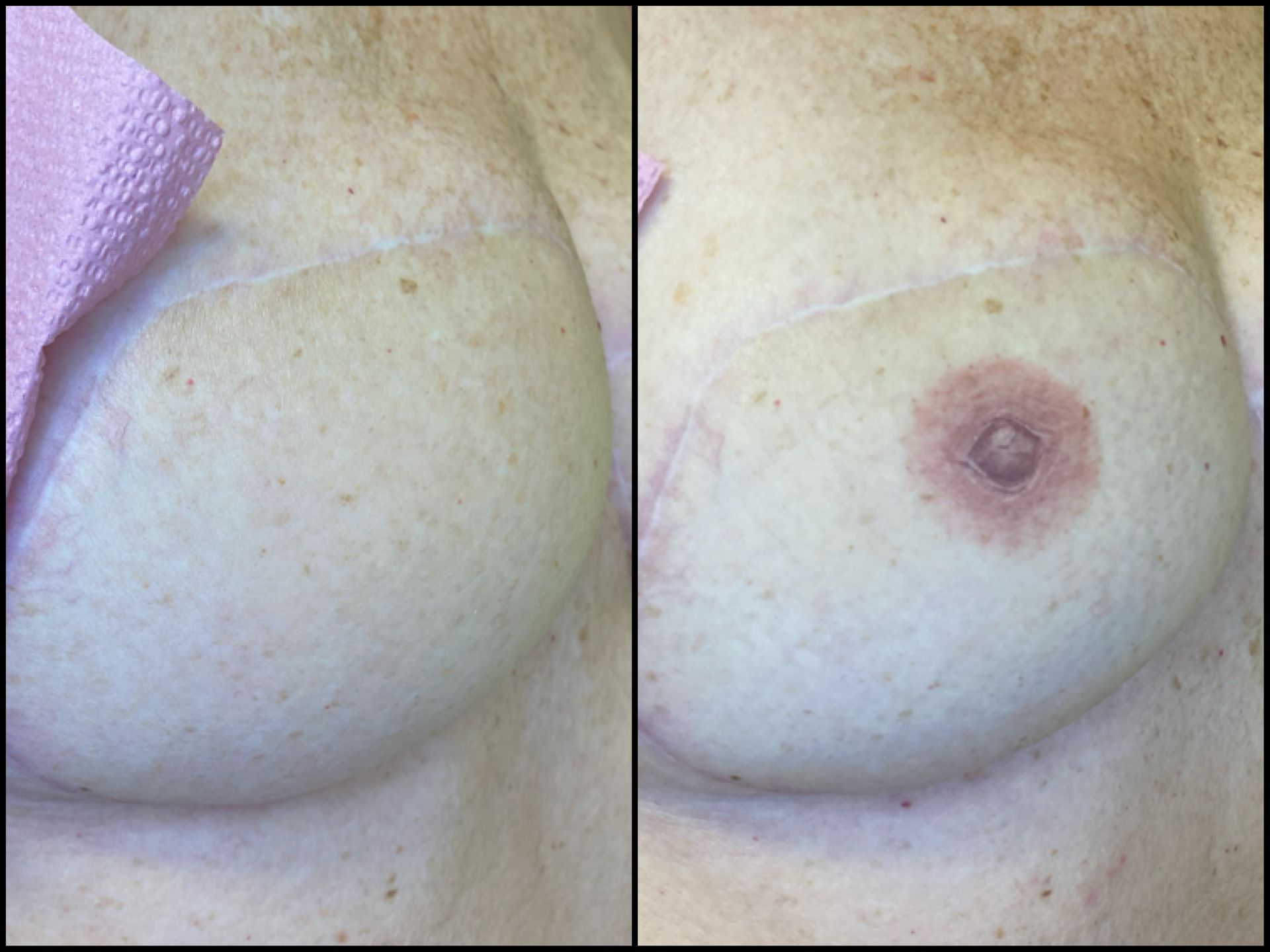 Before and after, healed