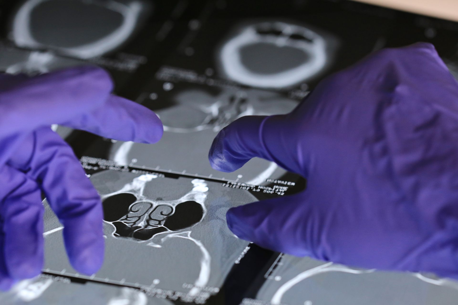 Hands in purple gloves examining medical scans.
