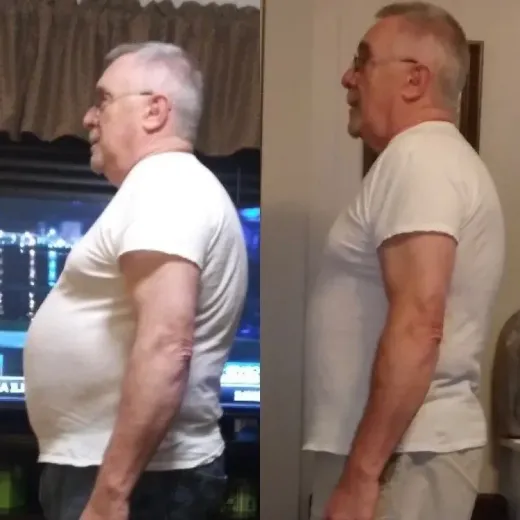 Before and after weight loss photos of an older man in a white shirt; profile views.