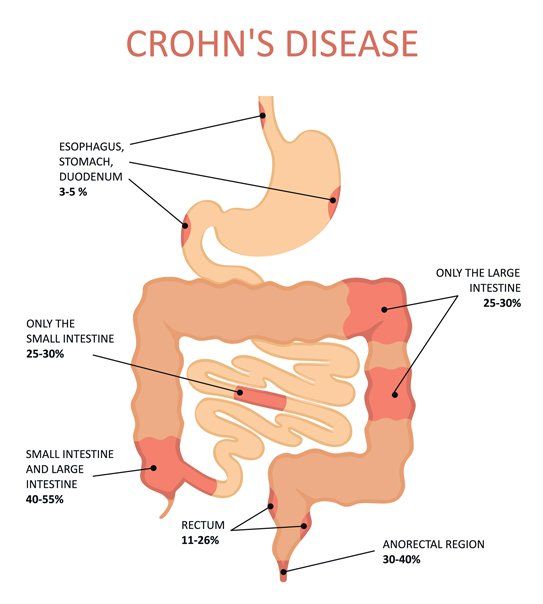 Crohn's Disease Treatments NYC by Dr. Dana Cohen MD  Natural Remedies for Crohn's Disease in Manhattan NY 10019