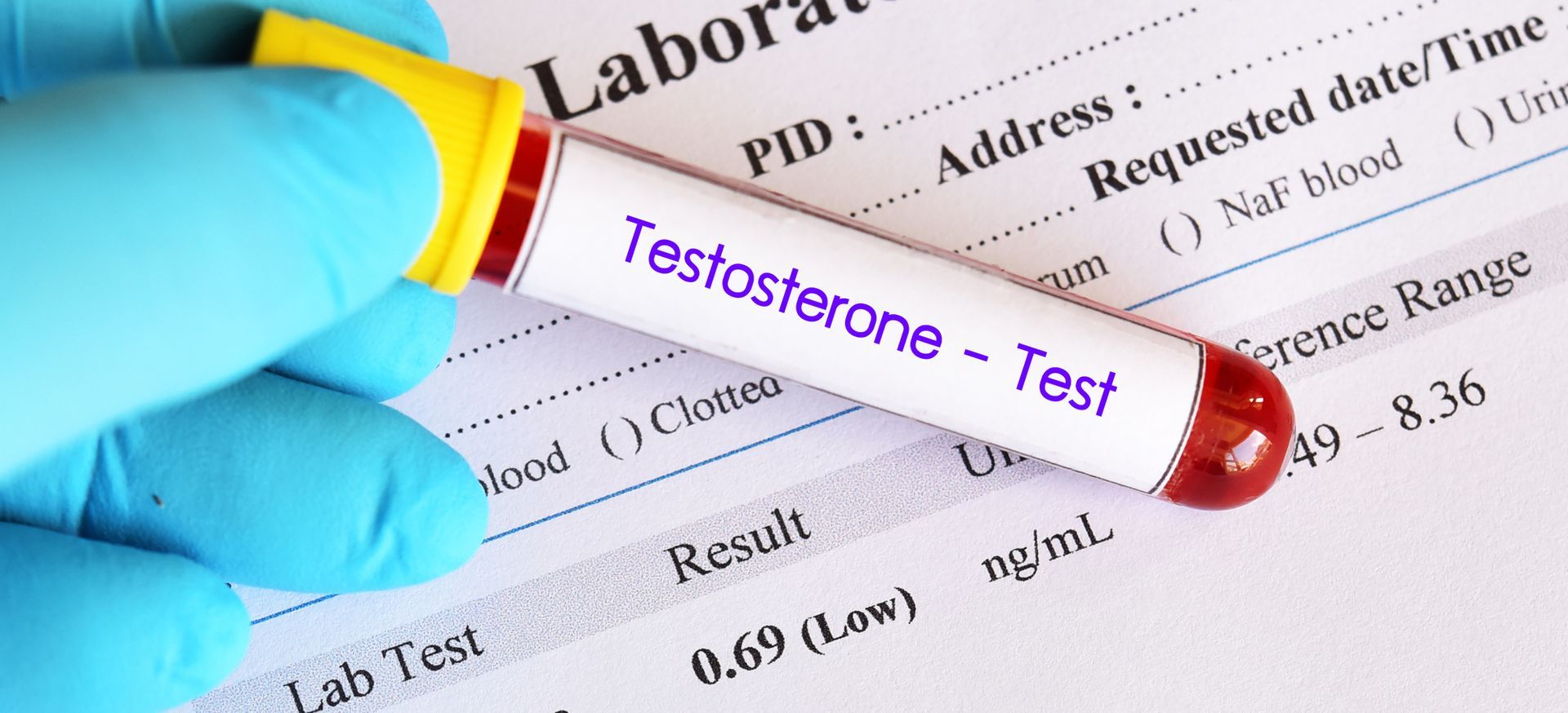 A person is holding a test tube that says testosterone test on it.