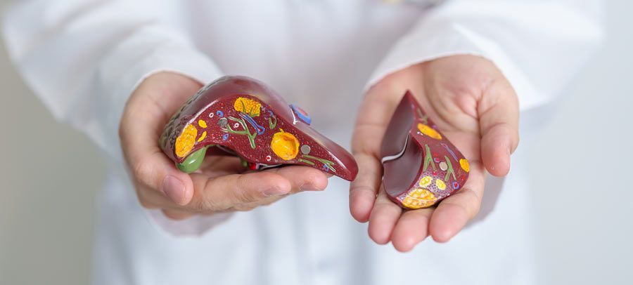 Understanding Fatty Liver Disease From An Integrative Perspective