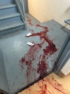 An before shot of a bloody floor from a crime scene cleanup in Ohio by Kingdom Bio Recovery & Restoration