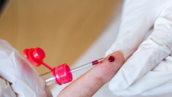 Ayurveda voeding en leefstijltherapeut