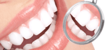 check-up odontoiatrico