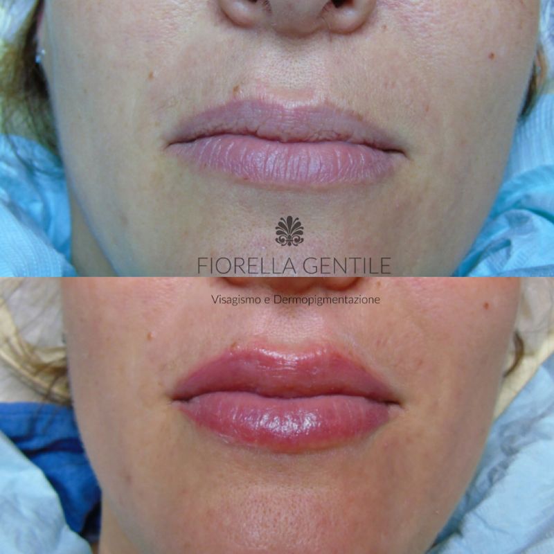 trucco permanente per labbra