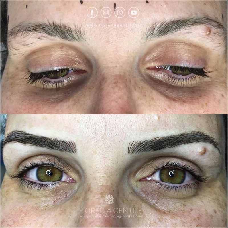 dermopigmentazione sopracciglia
