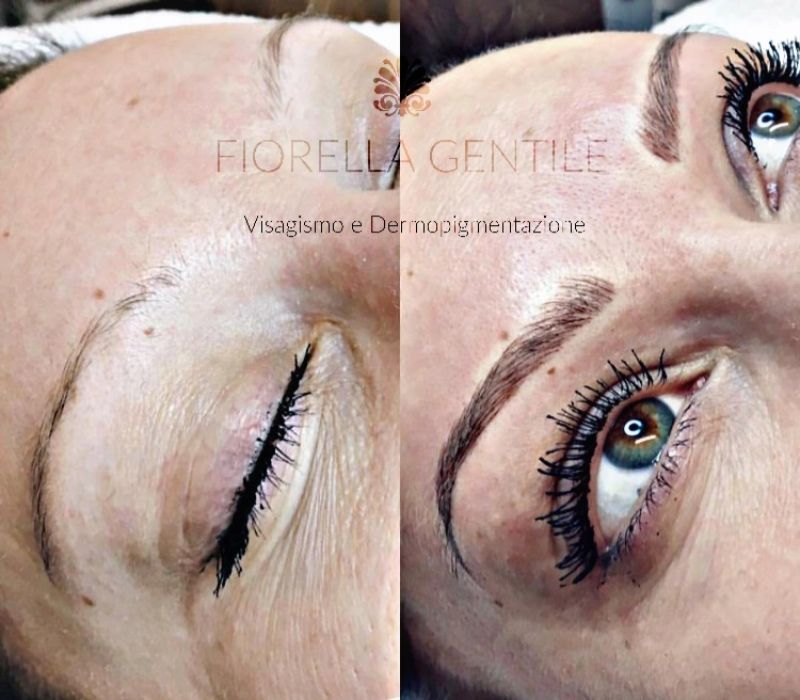 correzione asimmetria nelle sopracciglia