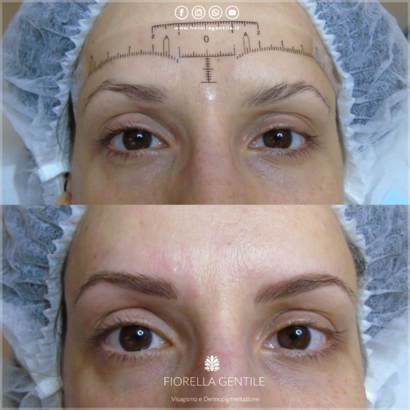 ripristinare asimmetrie