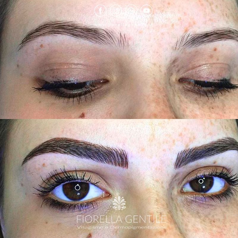 pigmentazione dell'epidermide