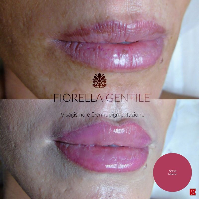 effetto labbra carnose