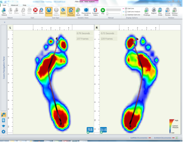 A Computer Screen Shows a Pair of Footprints with A Red Circle in The Middle — Illawarra Sports Injury Rehabilitation and Physiotherapy Centre in Bellambi, NSW