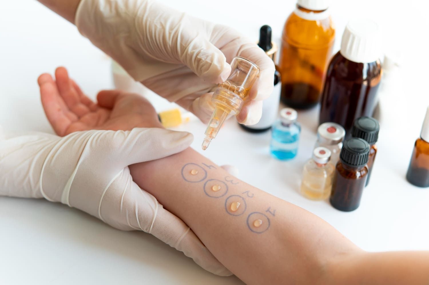 Allergy Testing Tampa
