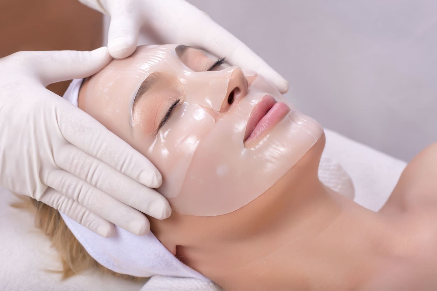 CHEMICAL PEEL Tampa
